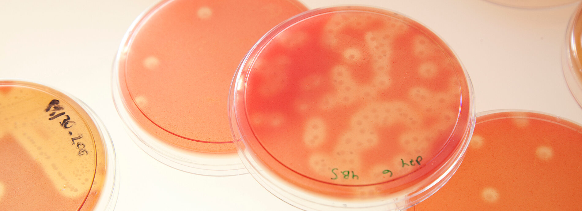 Protecting vulnerable communities from the threat of viral diseases