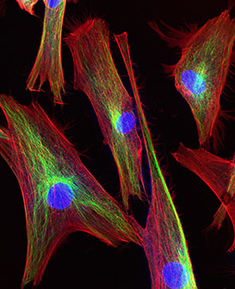 Confocal microscopy of fibroblast cells 