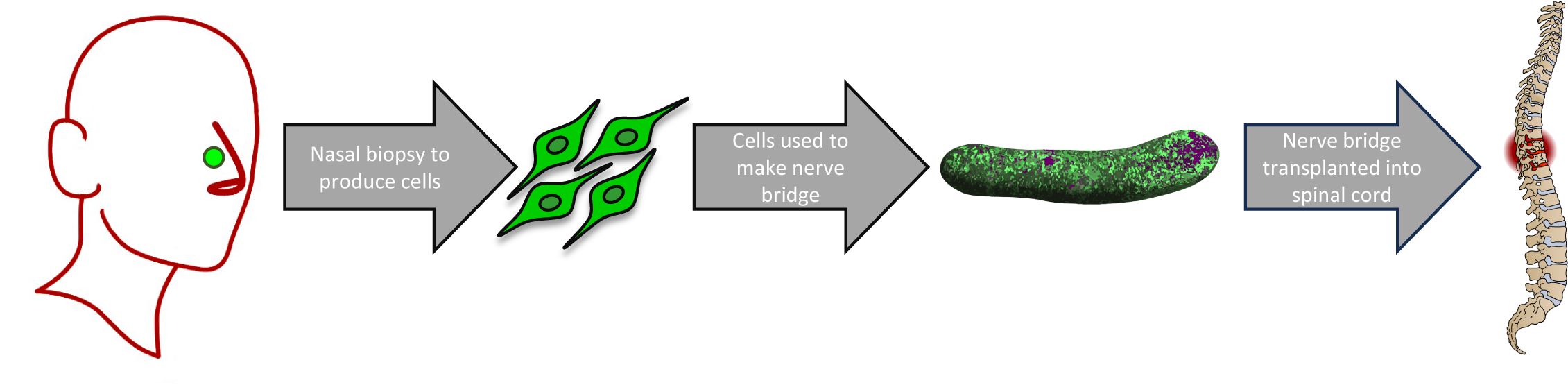 flow chart image showing the process for extraction of olfactory cells using a nasal biopsy